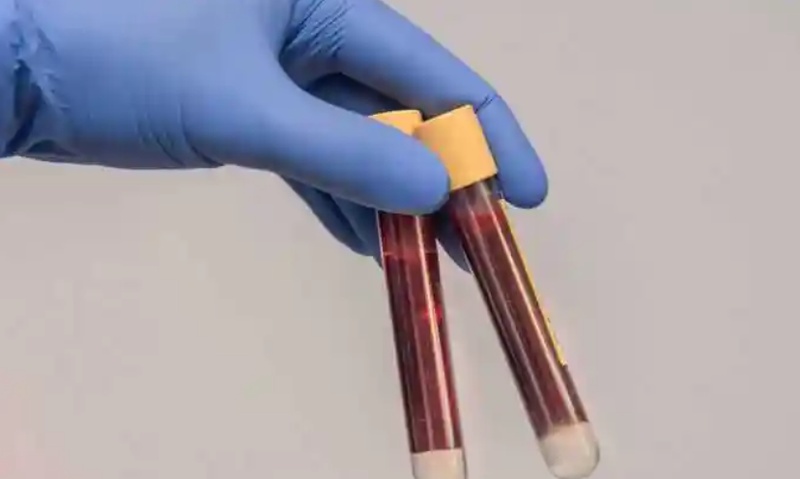 你的血管正在被悄悄侵蚀:那个你以为安全的血脂数字,可能已经害了你 健康养生